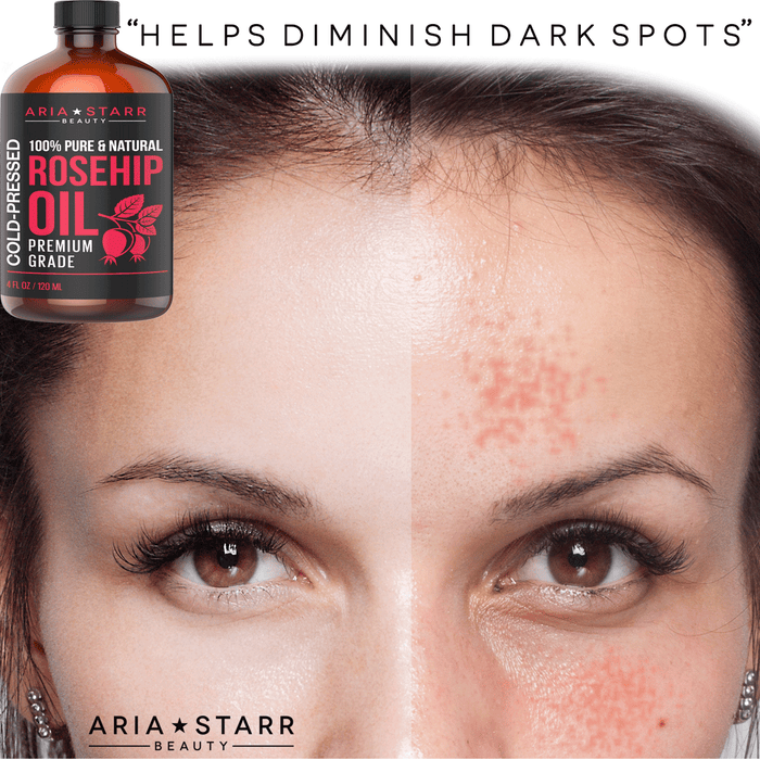 Rosehip Seed Oil Organic Cold Pressed