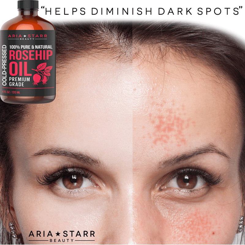 Rosehip Seed Oil Organic Cold Pressed